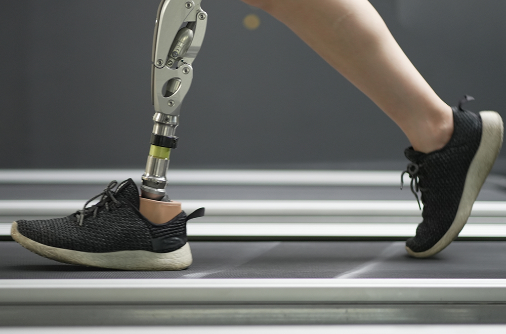 Prosthetic